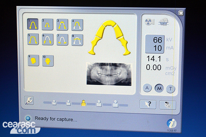 Odontologia Esportiva - 6